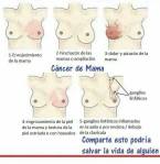 Cancer de Mama